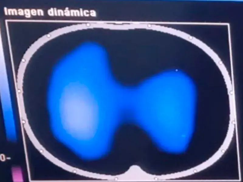 Imágenes de tomografía que se toman para analizar el desempeño de la fisioterapia con el inventivo Ubicu